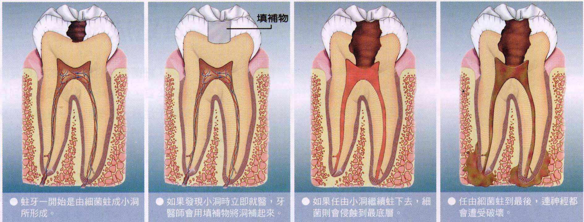 牙体牙髓科看什么,牙髓科主要治疗什么